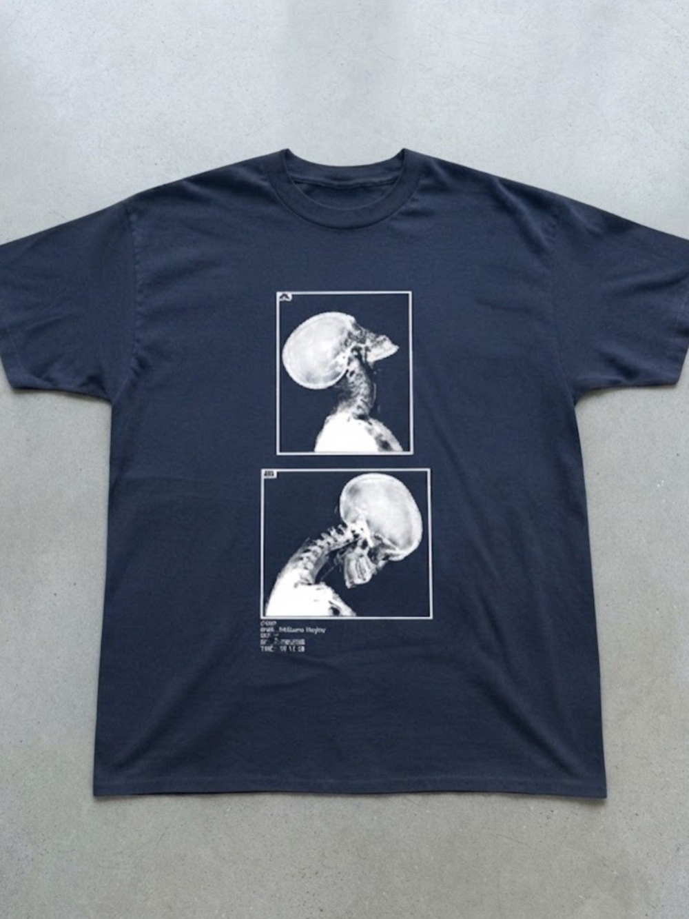 Anatomical X-ray Skull Study Dark Navy Blue Gildan T-Shirt